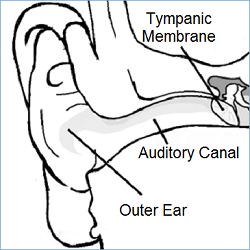 http://www.novamed-usa.com/images/Auditory%20Canal%20Image%20NovaMed%202016.png